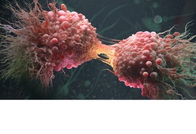 Cancer